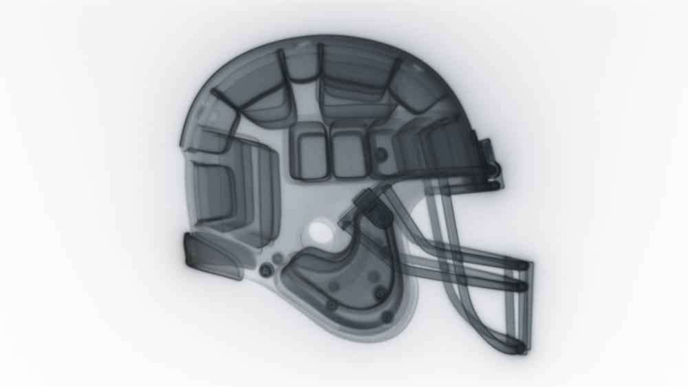 Chokerende sandheder om smerter i knæ, du skal kende!